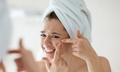 Acnes Treatment Tips: Don’t Do Things