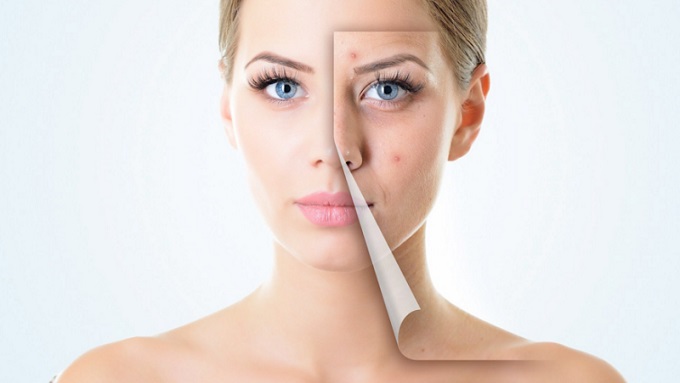 Acne Scar Healing Strategies for Sensitive Skin