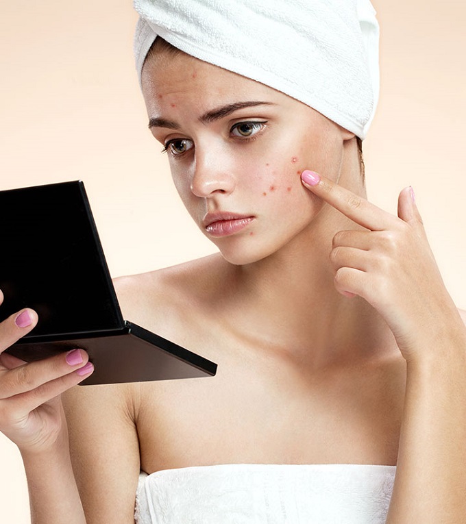 Acne Scar Healing Strategies for Sensitive Skin.